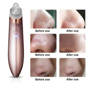 Blackhead Remover Face Acne Black Dot Pimple Electric Blackhead Vacuum Cleaner Pore Skin Care Tool Machine 4 Replacement Head HA STORE